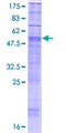 RHBDL3 Protein - 12.5% SDS-PAGE of human RHBDL3 stained with Coomassie Blue
