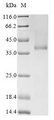 RHD Protein - (Tris-Glycine gel) Discontinuous SDS-PAGE (reduced) with 5% enrichment gel and 15% separation gel.