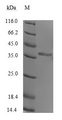 Human Rhinovirus A VP1 Protein - (Tris-Glycine gel) Discontinuous SDS-PAGE (reduced) with 5% enrichment gel and 15% separation gel.