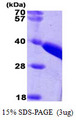 Rhodanese / TST Protein
