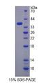 Rhodanese / TST Protein - Recombinant Thiosulfate Sulfurtransferase (TST) by SDS-PAGE