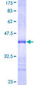 RHOQ / TC10 Protein - 12.5% SDS-PAGE Stained with Coomassie Blue.
