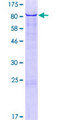 RIC3 Protein - 12.5% SDS-PAGE of human RIC3 stained with Coomassie Blue