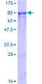 RICK / RIP2 Protein - 12.5% SDS-PAGE of human RIPK2 stained with Coomassie Blue