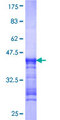 RIOK1 Protein - 12.5% SDS-PAGE Stained with Coomassie Blue.