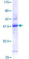 RMA1 / RNF5 Protein - 12.5% SDS-PAGE of human RNF5 stained with Coomassie Blue