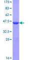 RMI2 / C16orf75 Protein - 12.5% SDS-PAGE of human RMI2 stained with Coomassie Blue