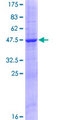 RNASE11 Protein - 12.5% SDS-PAGE of human RNASE11 stained with Coomassie Blue