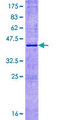 RNASE8 Protein - 12.5% SDS-PAGE of human RNASE8 stained with Coomassie Blue