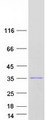 RNASEH2B Protein - Purified recombinant protein RNASEH2B was analyzed by SDS-PAGE gel and Coomassie Blue Staining