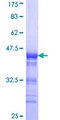 RNF113B Protein - 12.5% SDS-PAGE Stained with Coomassie Blue.