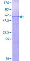 RNF151 Protein - 12.5% SDS-PAGE of human RNF151 stained with Coomassie Blue