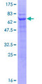 RNF167 Protein - 12.5% SDS-PAGE of human RNF167 stained with Coomassie Blue