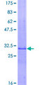 RNF170 Protein - 12.5% SDS-PAGE Stained with Coomassie Blue.
