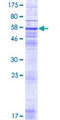 RNF175 Protein - 12.5% SDS-PAGE of human RNF175 stained with Coomassie Blue