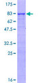 RNF180 Protein - 12.5% SDS-PAGE of human RNF180 stained with Coomassie Blue