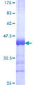 RNF19A / DORFIN Protein - 12.5% SDS-PAGE Stained with Coomassie Blue.
