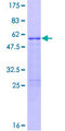 RNF207 Protein - 12.5% SDS-PAGE of human FLJ46380 stained with Coomassie Blue