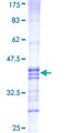 RNF212 Protein - 12.5% SDS-PAGE Stained with Coomassie Blue.