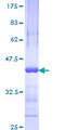 RNF220 / C1orf164 Protein - 12.5% SDS-PAGE Stained with Coomassie Blue.