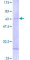 RNF32 Protein - 12.5% SDS-PAGE of human RNF32 stained with Coomassie Blue
