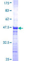 RNF40 / STARING Protein - 12.5% SDS-PAGE Stained with Coomassie Blue.