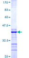 RNFT1 Protein - 12.5% SDS-PAGE Stained with Coomassie Blue.