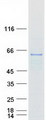 RNMT / HCM Protein - Purified recombinant protein RNMT was analyzed by SDS-PAGE gel and Coomassie Blue Staining