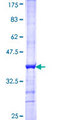 RNPEP Protein - 12.5% SDS-PAGE Stained with Coomassie Blue.