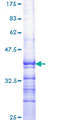 RORA / ROR Alpha Protein - 12.5% SDS-PAGE Stained with Coomassie Blue.