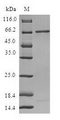 RP2 Protein - (Tris-Glycine gel) Discontinuous SDS-PAGE (reduced) with 5% enrichment gel and 15% separation gel.