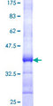 RP2 Protein - 12.5% SDS-PAGE Stained with Coomassie Blue.