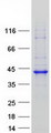 RP2 Protein - Purified recombinant protein RP2 was analyzed by SDS-PAGE gel and Coomassie Blue Staining