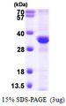 RPA2 / RFA2 / RPA34 Protein