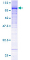 RPAP3 / FLJ21908 Protein - 12.5% SDS-PAGE of human FLJ21908 stained with Coomassie Blue