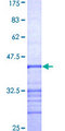 RPGR Protein - 12.5% SDS-PAGE Stained with Coomassie Blue.