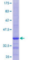 RPL10L Protein - 12.5% SDS-PAGE Stained with Coomassie Blue.