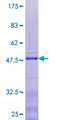 RPL24 / Ribosomal Protein L24 Protein - 12.5% SDS-PAGE of human RPL24 stained with Coomassie Blue