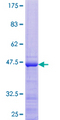 RPL26L1 Protein - 12.5% SDS-PAGE of human RPL26L1 stained with Coomassie Blue