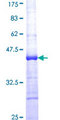 RPL26L1 Protein - 12.5% SDS-PAGE Stained with Coomassie Blue.
