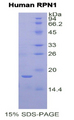 RPN1 / Ribophorin I Protein - Recombinant Ribophorin I By SDS-PAGE