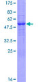 RPP40 / Ribonuclease P Protein - 12.5% SDS-PAGE of human RPP40 stained with Coomassie Blue