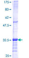 RPP40 / Ribonuclease P Protein - 12.5% SDS-PAGE Stained with Coomassie Blue.
