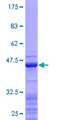 RPS15 / Ribosomal Protein S15 Protein - 12.5% SDS-PAGE of human RPS15 stained with Coomassie Blue