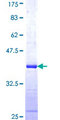 RPS20 / Ribosomal Protein S20 Protein - 12.5% SDS-PAGE Stained with Coomassie Blue.
