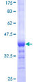 RPS21 / Ribosomal Protein S21 Protein - 12.5% SDS-PAGE Stained with Coomassie Blue.