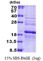 RPS24 / Ribosomal Protein S24 Protein
