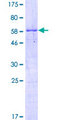 RPS3A / Ribosomal Protein S3A Protein - 12.5% SDS-PAGE of human RPS3A stained with Coomassie Blue