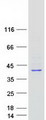 RRAGB / RAGB Protein - Purified recombinant protein RRAGB was analyzed by SDS-PAGE gel and Coomassie Blue Staining