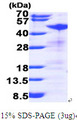 RRM2 Protein
